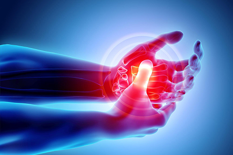Physical Therapy Brickell, FL - Arthritis Treatment
