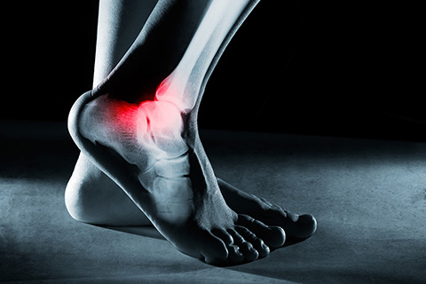 Physical Therapy Brickell, FL - Foot & Ankle Pain Treatment