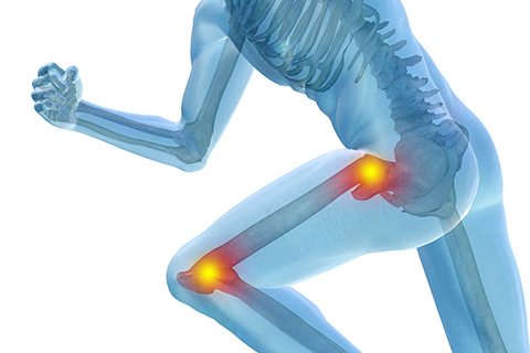Physical Therapy Brickell, FL - Hip & Knee Pain Treatment