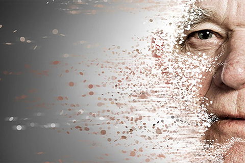 Physical Therapy Brickell, FL - Vertigo Treatment